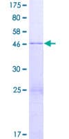 Human ZNF740 Protein (Recombinant GST)