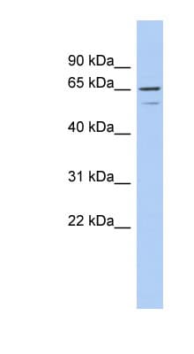 TNFRSF1A / TNFR1 Antibody (N-Terminus)