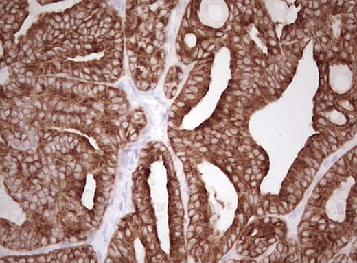 Monoclonal Mouse anti-Human Basic Cytokeratin AE3 Antibody (clone AE3, Carrier-free, IHC)