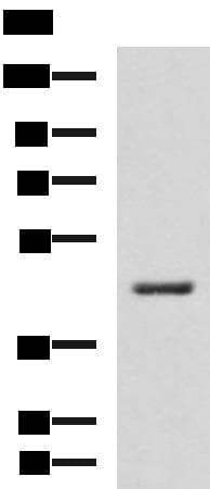 HSD3B2 Antibody