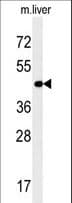 IHC-plus™ Polyclonal Rabbit anti-Human PAOX / PAO Antibody (aa467-496, IHC, WB)