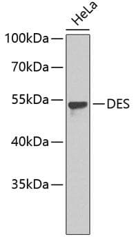 DES / Desmin Antibody