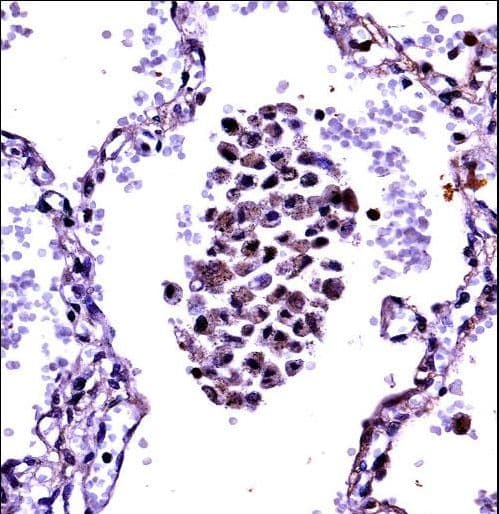 NFKBIB / IKB Beta / IKBB Antibody (aa326-355)