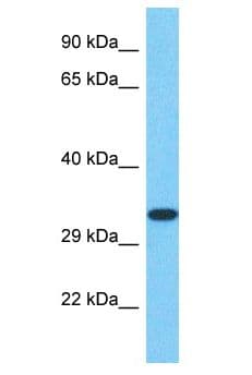 SPT7L / SUPT7L Antibody (aa191-240)