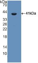 CSPG5 / Neuroglycan C Antibody (aa139-370)