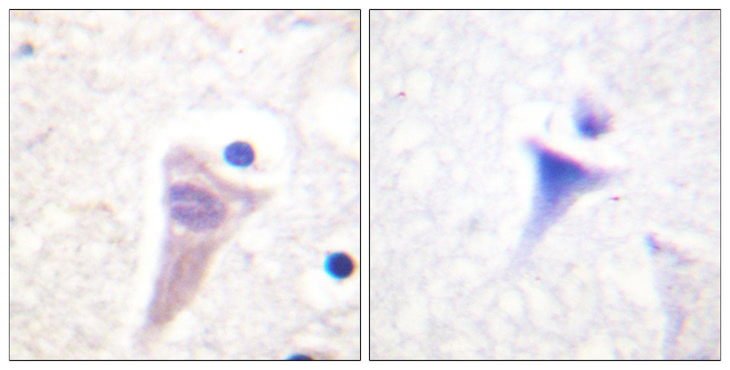 CALM1 / Calmodulin Antibody (phospho-Thr79+Ser81)