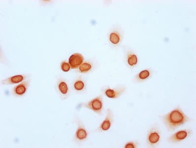 HIST1H2BN Antibody