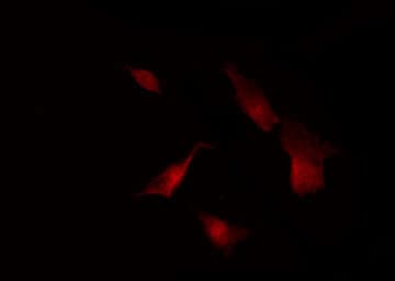 Polyclonal Rabbit anti-Human EIF4EBP1 / 4EBP1 Antibody (IHC, IF, WB)