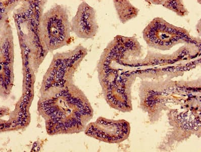 TANK2 / TNKS2 Antibody