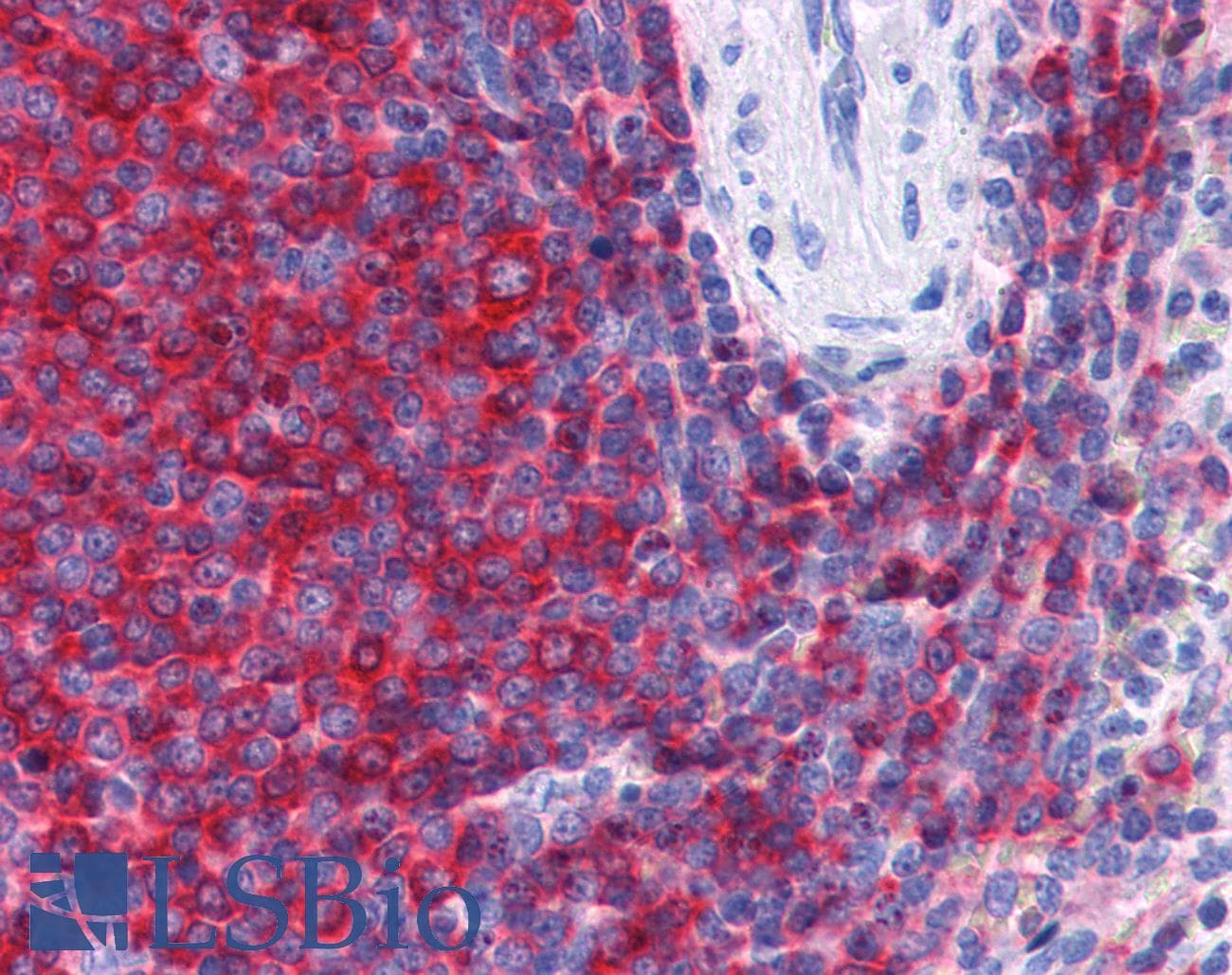 IHC-plus™ SH3BP1 Antibody (aa689-701)