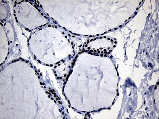 ELL / MEN Antibody (aa302-621, clone OTI1C12, Carrier-free)