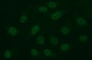 MMP13 Antibody (aa104-471, clone OTI3G1)