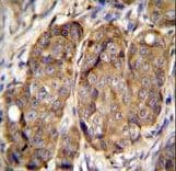 METTL2B Antibody (aa329-359)