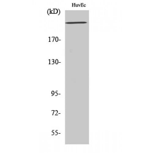Polyclonal Rabbit anti-Human KDR / VEGFR2 / FLK1 Antibody (1110-1190 aa, IHC, WB)