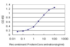 F9 / Factor IX Antibody (clone 2C9)