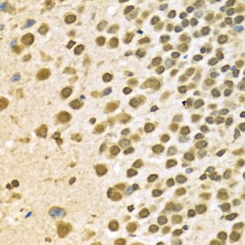 HNRNPA2B1 Antibody
