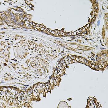 FDX1 / ADX Antibody