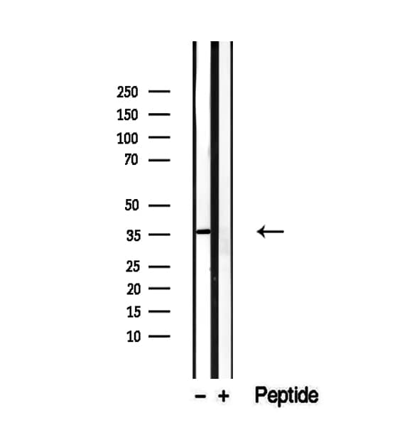 SGCG / Gamma-Sarcoglycan Antibody