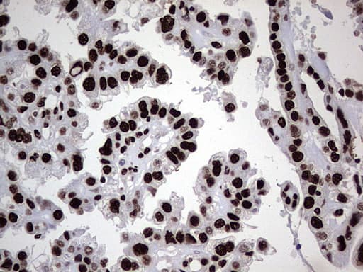 HNRNPL / hnRNP L Antibody (aa270-502, clone OTI9F11)