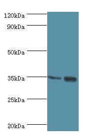 MAGEA6 Antibody (aa75-314)
