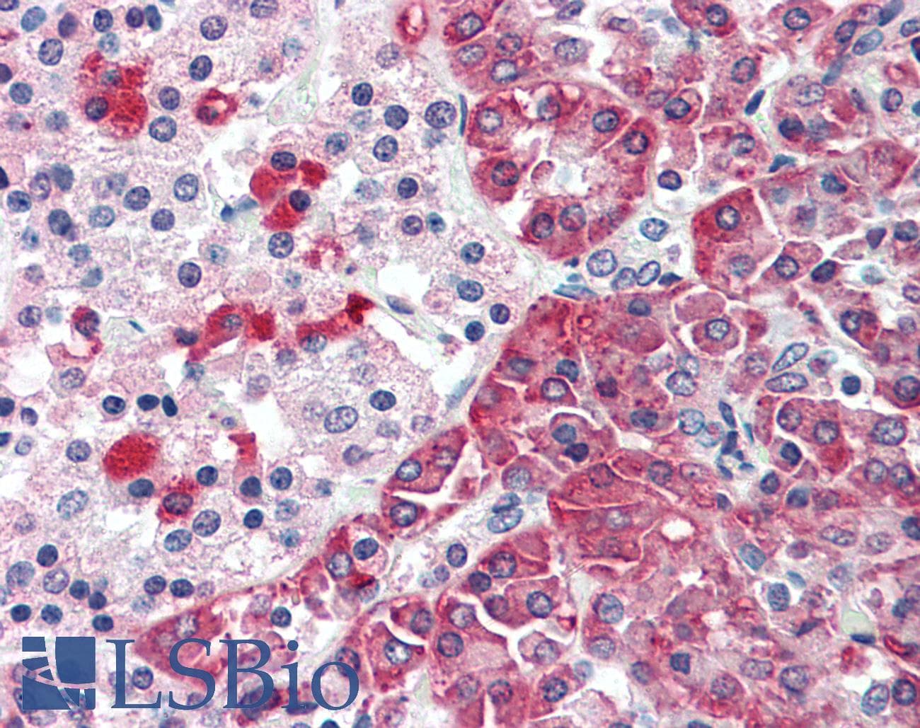 IHC-plus™ TMPRSS4 Antibody (Internal)