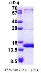 Human TEN1 Protein (Recombinant His)