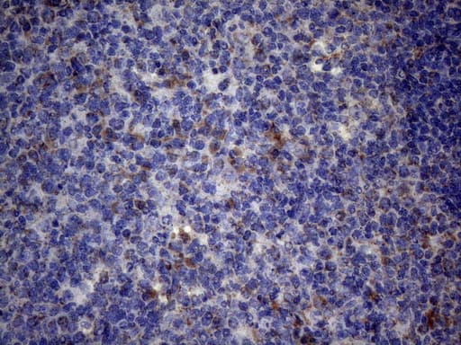 PPIF / Cyclophilin F Antibody (clone OTI1C4)
