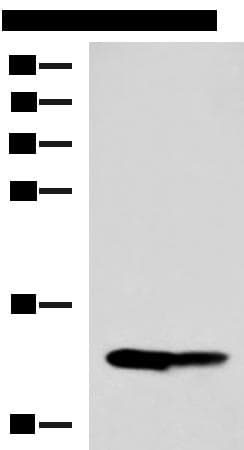 Polyclonal Rabbit anti-Human HRSP12 / UK114 Antibody (IHC, WB)