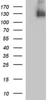 PDGFRB / PDGFR Beta Antibody (clone OTI1E8, Carrier-free)
