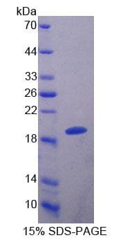 Bovine S100A8 / MRP8 Protein (Recombinant His-S)