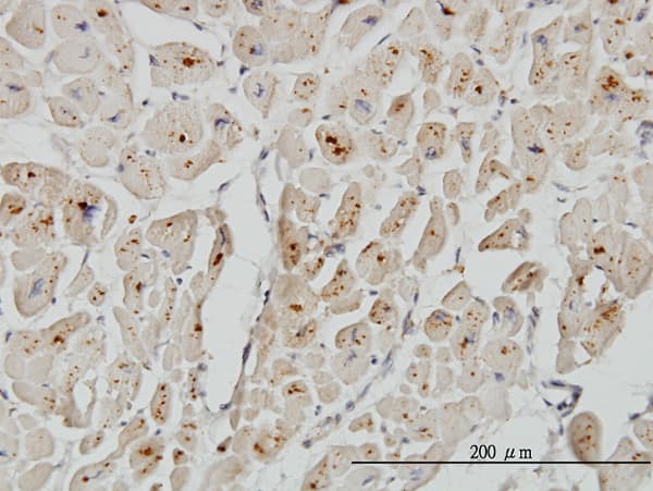 ASAH1 / Acid Ceramidase Antibody (clone 2C9)