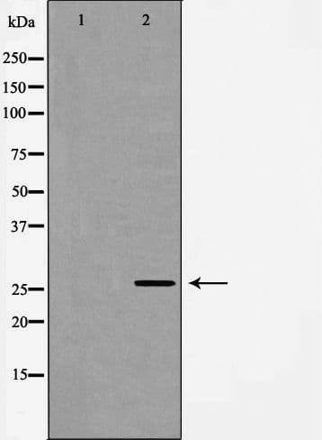 Polyclonal Rabbit anti-Human NEUROG1 / NGN1 / Neurogenin 1 Antibody (IHC, WB)