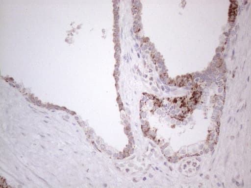 Monoclonal Mouse anti-Human BP1 / DLX4 Antibody (clone OTI8A1, IHC, WB)