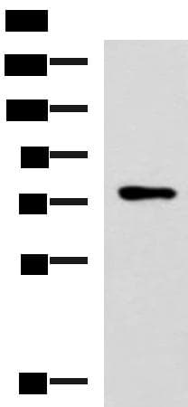 L3MBTL2 Antibody