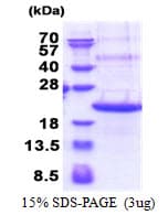 Human TREM2 / TREM-2 Protein (Recombinant His)