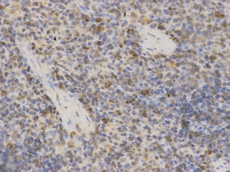 IHC-plus™ Polyclonal Rabbit anti-Human MAOA / Monoamine Oxidase Antibody (IHC, WB)