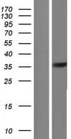 FYTTD1 Protein (Over-Expression Lysate Myc-DDK (Flag))