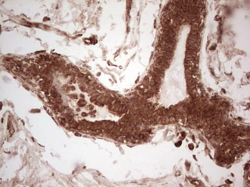 UBE2D2 / UBCH5B Antibody (clone OTI1D11)