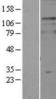 TPD52L2 / HD54 Protein (Over-Expression Lysate Myc-DDK (Flag))