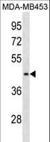 ALG8 Antibody (aa15-41)