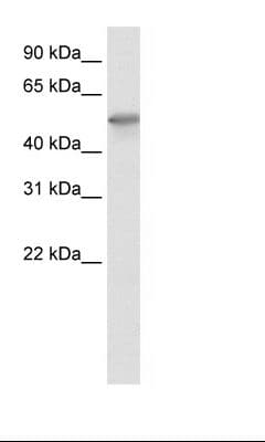Polyclonal Rabbit anti-Human FOXO3 / FOXO3A Antibody (C-Terminus, IHC, WB)