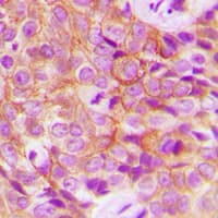 EGFR Antibody (phospho-Thr693)