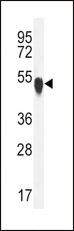 Polyclonal Rabbit anti-Human TUBA1C / Tubulin Alpha 1C Antibody (aa414-441, IHC, WB)