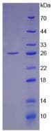Human LIF Protein (Recombinant His, N-Terminal)