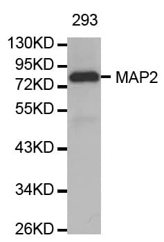 Polyclonal Rabbit anti-Human MAP2 Antibody (IHC, WB)