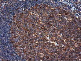MAP2K1 / MKK1 / MEK1 Antibody (clone OTI4E1)
