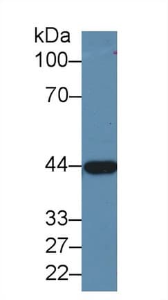 ADH1A / Alcohol Dehydrogenase Antibody (aa169-370, APC)
