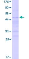 Human NEUROG2 / NGN2 / Neurogenin 2 Protein (Recombinant GST)