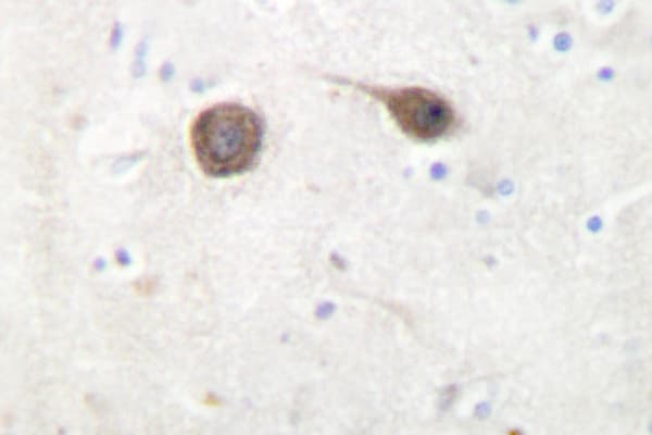 Polyclonal Rabbit anti-Human MAPK8IP2 / JIP2 Antibody (Asn601, IHC, IF, WB)
