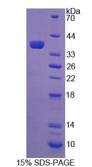 Human COASY Protein (Recombinant His, N-Terminal)